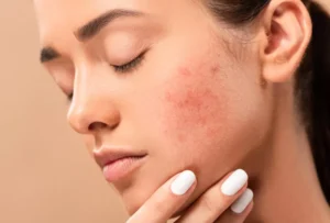 وداعًا لآثار الجروح