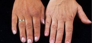 أصحاب الحالات الصعبة